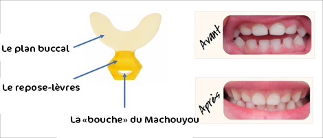 Machouyou - Inventé par un dentiste, Machouyou permet le